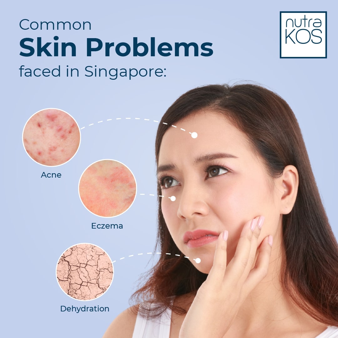 Nutra KOS Skin Common Problems